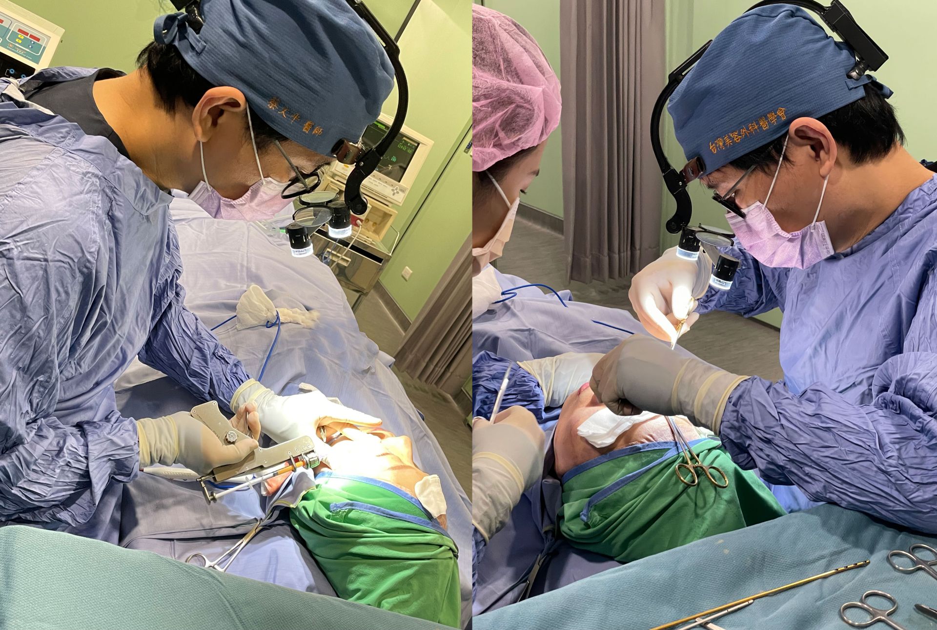 眼袋脂肪Say Goodbye！獨特技法重塑完美雙眸